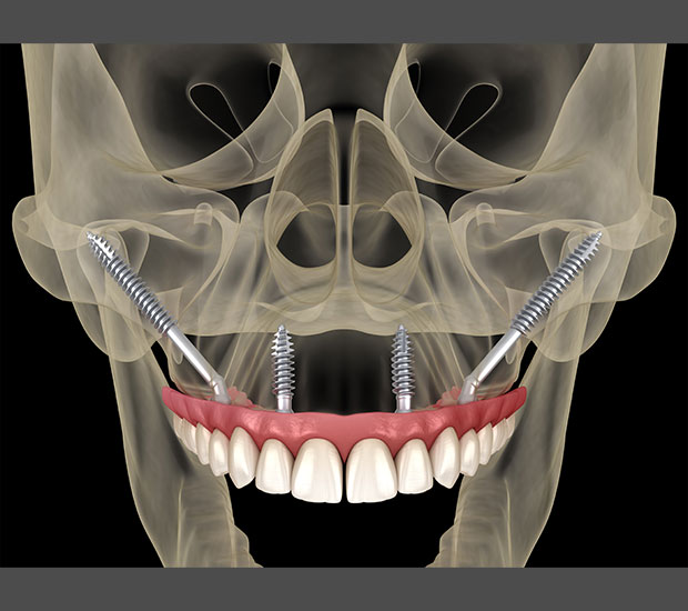 Stratford Oral Surgeon