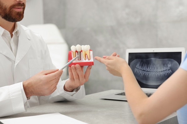 When Tooth Extraction With Dental Implants Is Recommended