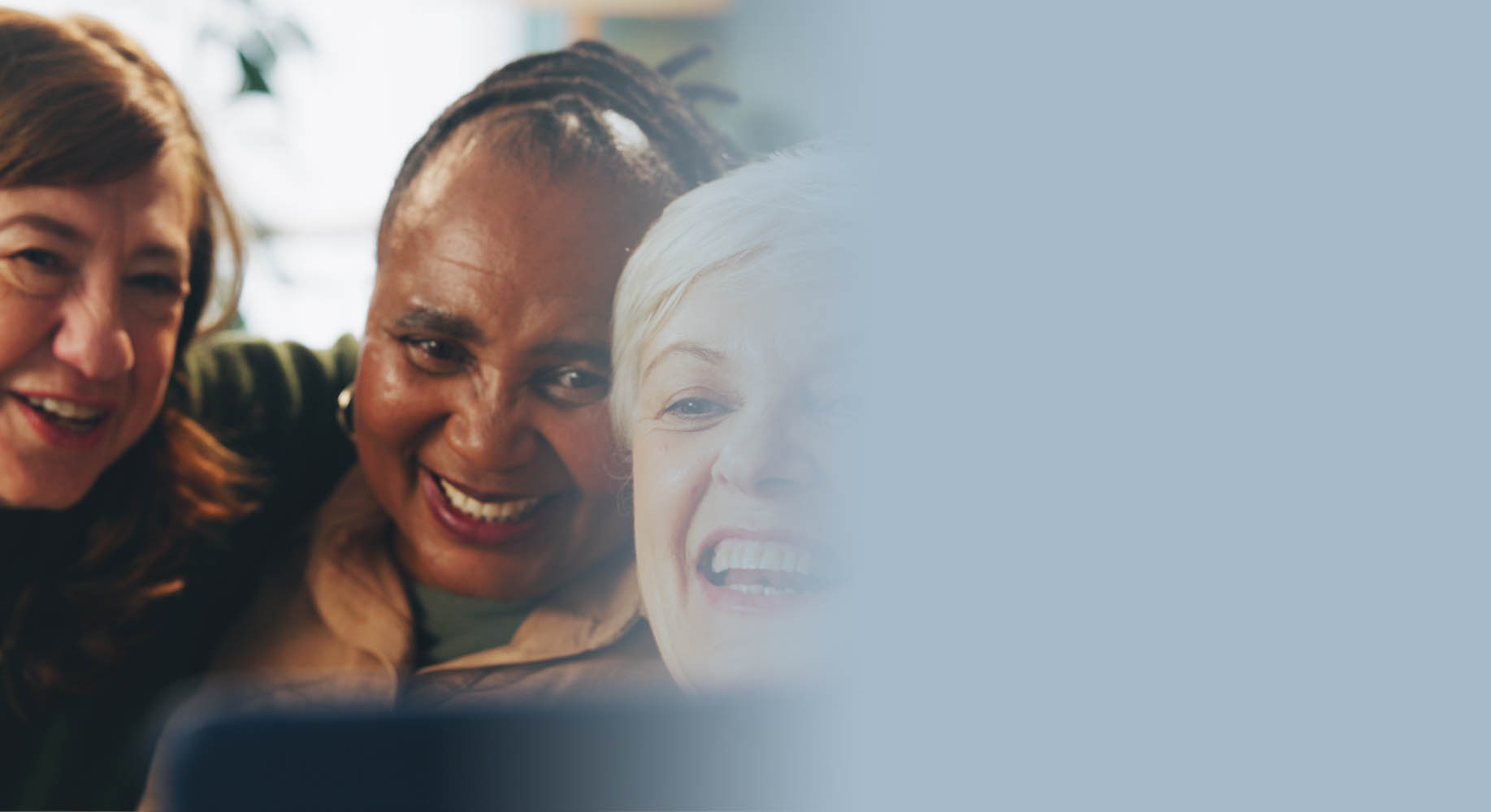 All-on-4 Dental Implants 
